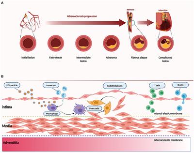 The Emerging Role of Rho Guanine Nucleotide Exchange Factors in Cardiovascular Disorders: Insights Into Atherosclerosis: A Mini Review